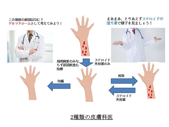 円形脱毛症　病院